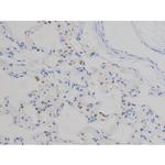 Phospho-IGF1R (Tyr1165, Tyr1166) Antibody in Immunohistochemistry (Paraffin) (IHC (P))