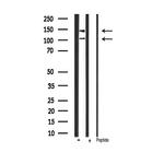 Phospho-IGF1R (Tyr1165, Tyr1166) Antibody in Western Blot (WB)