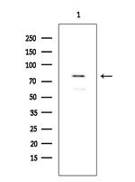 FOXP1 Antibody in Western Blot (WB)