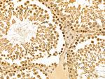 HSP70 Antibody in Immunohistochemistry (Paraffin) (IHC (P))