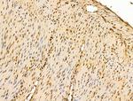 HSP70 Antibody in Immunohistochemistry (Paraffin) (IHC (P))