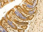 HSP70 Antibody in Immunohistochemistry (Paraffin) (IHC (P))