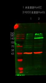 Phospho-eNOS (Ser1179) Antibody in Western Blot (WB)