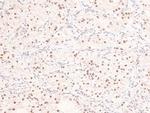 Phospho-53BP1 (Ser29) Antibody in Immunohistochemistry (Paraffin) (IHC (P))