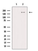 Phospho-53BP1 (Ser29) Antibody in Western Blot (WB)