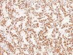 Phospho-BCLAF1 (Ser531) Antibody in Immunohistochemistry (Paraffin) (IHC (P))