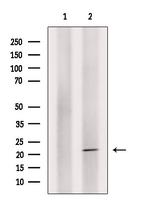 Phospho-Claudin 4 (Tyr208) Antibody in Western Blot (WB)