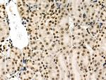 Phospho-MUC1 (Ser1227) Antibody in Immunohistochemistry (Paraffin) (IHC (P))