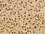 Phospho-NACA (Thr159) Antibody in Immunohistochemistry (Paraffin) (IHC (P))