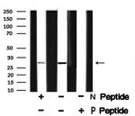 Phospho-PDX1 (Ser61) Antibody in Western Blot (WB)