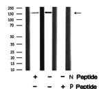 Phospho-RAD50 (Ser635) Antibody in Western Blot (WB)