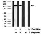 Phospho-p130 (Thr642) Antibody in Western Blot (WB)