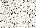 Phospho-Bcl-3 (Ser402) Antibody in Immunohistochemistry (Paraffin) (IHC (P))