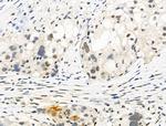 Phospho-Bcl-3 (Ser402) Antibody in Immunohistochemistry (Paraffin) (IHC (P))