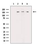 Phospho-TOP2A (Ser1337) Antibody in Western Blot (WB)