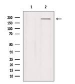 SCN9A Antibody in Western Blot (WB)