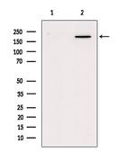 Myosin 4 Antibody in Western Blot (WB)