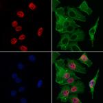 ATF1 Antibody in Immunocytochemistry (ICC/IF)