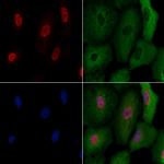 ATF1 Antibody in Immunocytochemistry (ICC/IF)