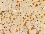 ATF1 Antibody in Immunohistochemistry (Paraffin) (IHC (P))