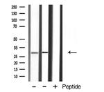 APOA1BP Antibody in Western Blot (WB)