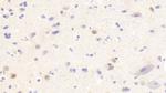 ANP32A Antibody in Immunohistochemistry (Paraffin) (IHC (P))