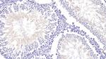 Angiogenin Antibody in Immunohistochemistry (Paraffin) (IHC (P))