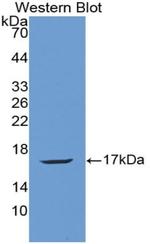 Angiogenin Antibody in Western Blot (WB)