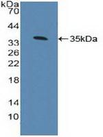 AHR Antibody in Western Blot (WB)