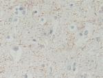 BLVRB Antibody in Immunohistochemistry (Paraffin) (IHC (P))