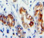 CD36 Antibody in Immunohistochemistry (Paraffin) (IHC (P))