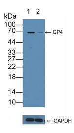 CD36 Antibody in Western Blot (WB)