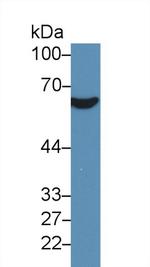 CD36 Antibody in Western Blot (WB)