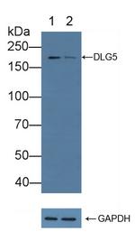 DLG5 Antibody in Western Blot (WB)