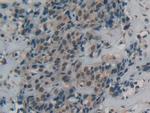 DbH Antibody in Immunohistochemistry (Paraffin) (IHC (P))