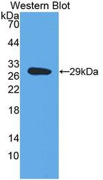 DbH Antibody in Western Blot (WB)