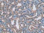 ENPP1 Antibody in Immunohistochemistry (Paraffin) (IHC (P))