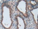 ENPP1 Antibody in Immunohistochemistry (Paraffin) (IHC (P))