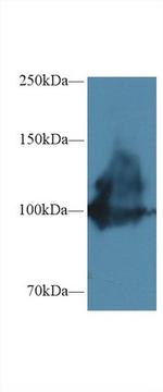 ENPP1 Antibody in Western Blot (WB)