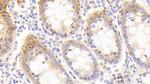 EpCAM (CD326) Antibody in Immunohistochemistry (Paraffin) (IHC (P))