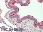 FOLR1 Antibody in Immunohistochemistry (Paraffin) (IHC (P))