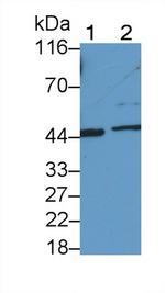 IL31RA Antibody in Western Blot (WB)