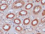 IDH1 Antibody in Immunohistochemistry (Paraffin) (IHC (P))