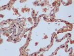 IDH1 Antibody in Immunohistochemistry (Paraffin) (IHC (P))