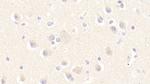 MPI Antibody in Immunohistochemistry (Paraffin) (IHC (P))