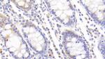 MPI Antibody in Immunohistochemistry (Paraffin) (IHC (P))