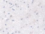 MPI Antibody in Immunohistochemistry (Paraffin) (IHC (P))