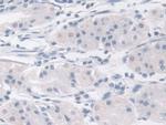 MPI Antibody in Immunohistochemistry (Paraffin) (IHC (P))