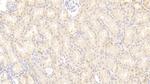 NUMB Antibody in Immunohistochemistry (Paraffin) (IHC (P))