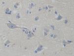 PFKP Antibody in Immunohistochemistry (Paraffin) (IHC (P))